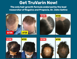 TruVarin Enriched Hair Growth Oil Truely Work