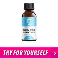 Revivo Skin Tag Remover Reviews: Amazon