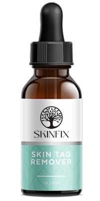 Skin Fix Skin Tag Remover: Smooth Away Skin Imperfections