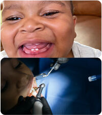 Paediatric/ Child Dental Care