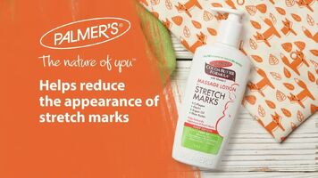 Palmer’s Stretch Mark Cream Must Read Before Buying?