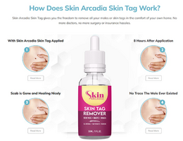What is Skin Arcadia Skin Tag Remover?