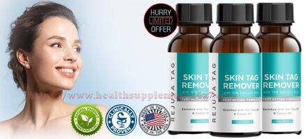 Rejuva Skin Tag Remover