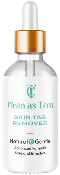 Clean As Teen Skin Tag Remover
