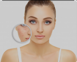 Defy Skin Tag Remover Reviews - Must Read Before You Buy!