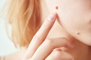 Skin Arcadia Skin Tag Remover: SCAM Exposed! Urgent Customer Response