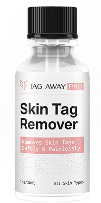 Tag Away Pro Skin Tag Remover