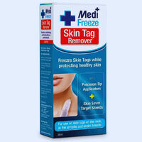 Medi Freeze Skin Tag Remover AU: The Ultimate Skin Tag Solution